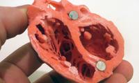 Тиббиётда 3D-чоп этиш технологияси: жонли юрак ва тўқималар